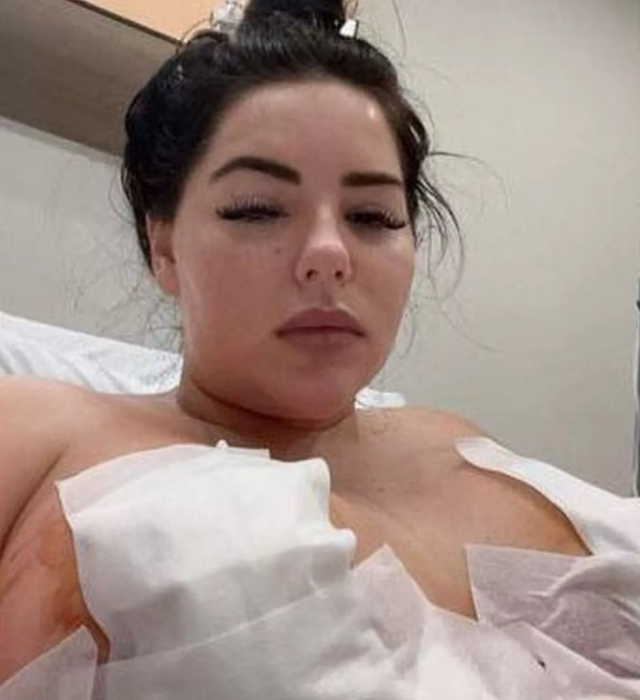 Meme dikleştirme operasyonu geçiren İngiliz model Chloe Rose'un göğüs uçları çürüdü