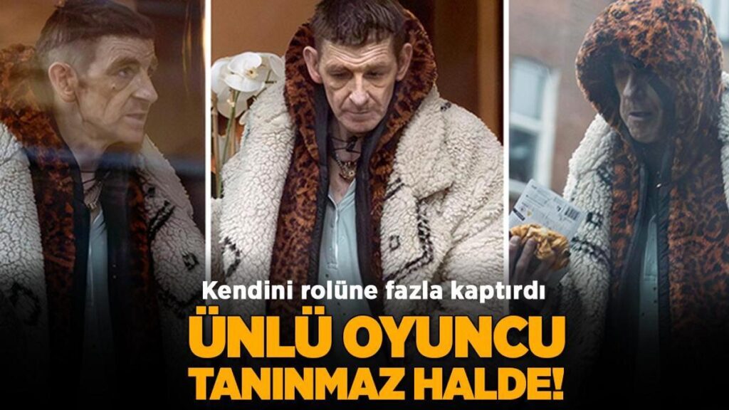 ‘Peaky Blinders’ın yıldızı tanınmaz halde! Uyuşturucu bağımlılığıyla mı mücadele ediyor?