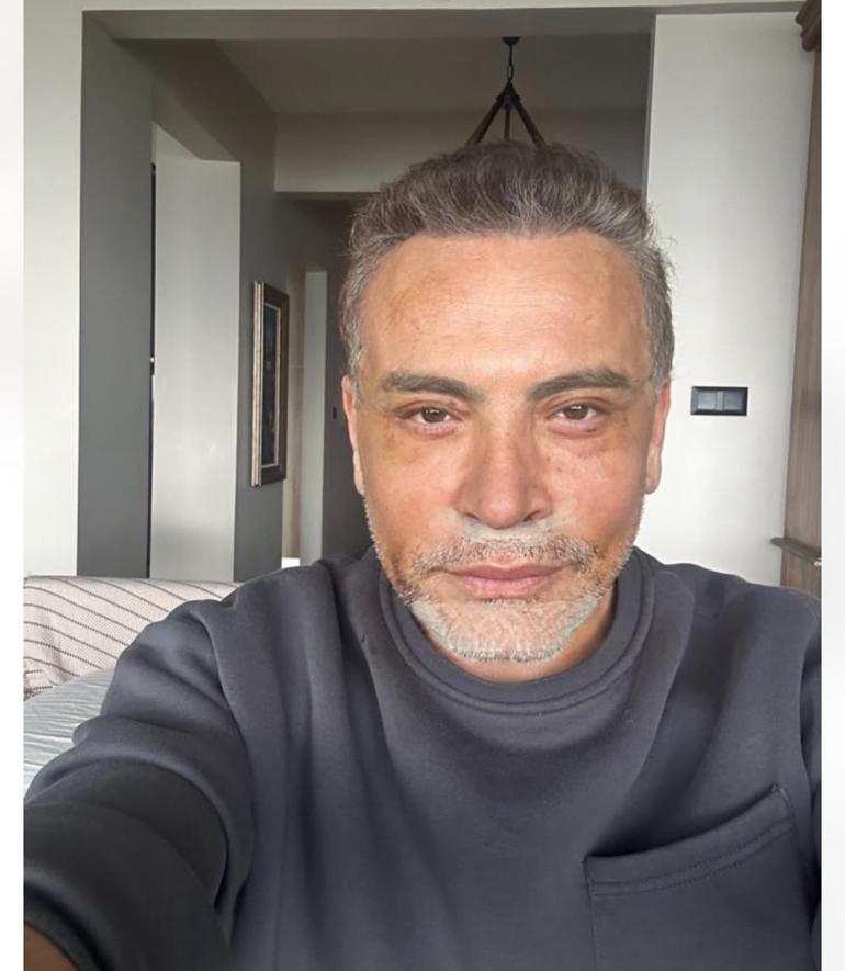 'Türkiye'nin George Clooney'siyim' demişti! Yüzünü gerdiren Cenk Eren son halini paylaştı