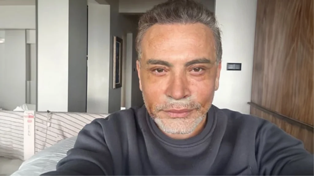 Yüz gerdirme ameliyatı olmuştu! İşte Cenk Eren’in son hali