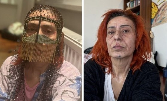 Yıldız Tilbeden Maskeli Pozun sebebi