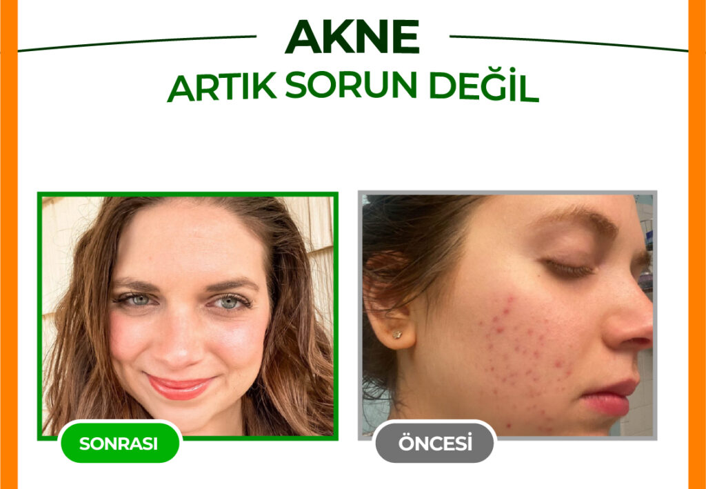 Wyess Nioli Yağı Mucizesi: Doğadan Gelen Şifa ve Koruma