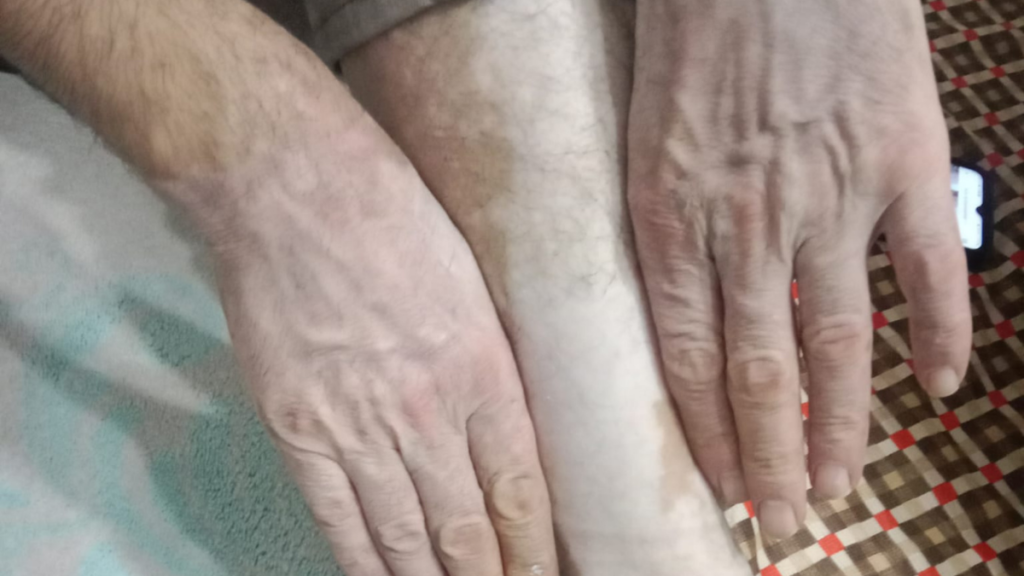 Medikal Kamuflajla Ciltte Yeni Bir Başlangıç: İkbal Yeşil’den Umut Veren Uygulamalar