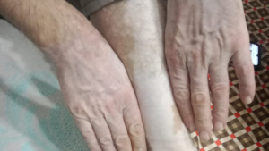 Medikal Kamuflajla Ciltte Yeni Bir Başlangıç: İkbal Yeşil’den Umut Veren Uygulamalar