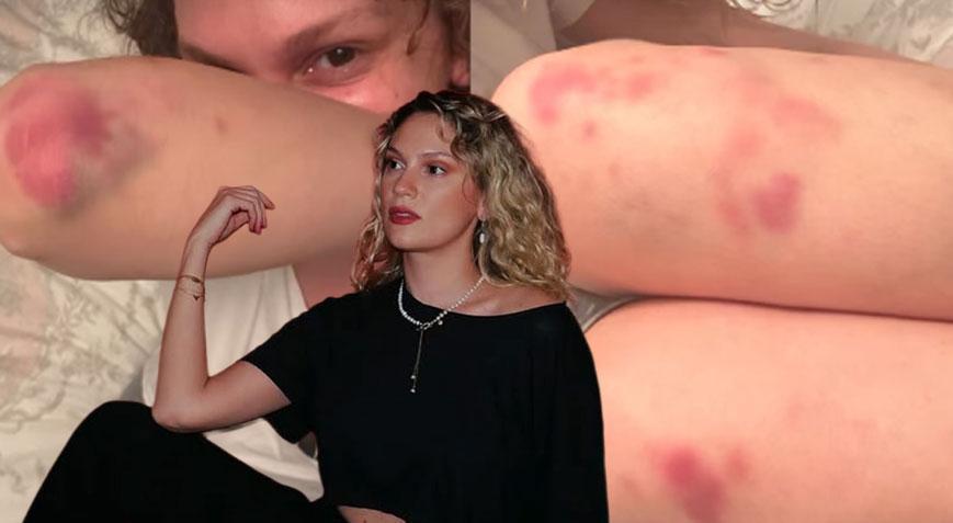 Yeni Film Heyecanı Morluklarla Geldi: Farah Zeynep Abdullah Takipçilerini Tedirgin Etti
