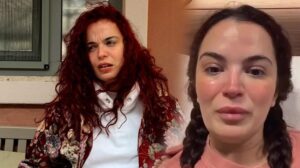 Aslı Bekiroğlu Peş Peşe Sağlık Sorunları Yaşıyor: 7. Ameliyat Sonrası Yeni Talihsizlik