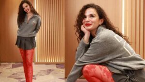 7 Kez Ameliyat Olan Aslı Bekiroğlu’ndan Sert Yorumlara Tepki