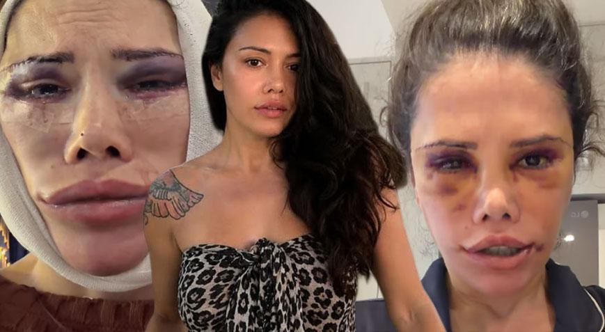 Didem Ceran ameliyat sonrası yaşadıklarını anlattı: “Nasıl çektiğimi hatırlamıyorum”
