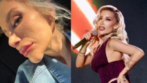 İrem Derici’den çenesindeki değişimle ilgili açıklama: Estetik değil