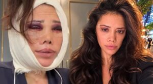 Didem Ceran’dan yeni estetik kararı